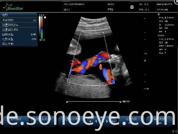 C10 Color Doppler Ultrasound System For Hostipal